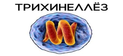 ПРОФИЛАКТИКА ТРИХИНЕЛЛЕЗА